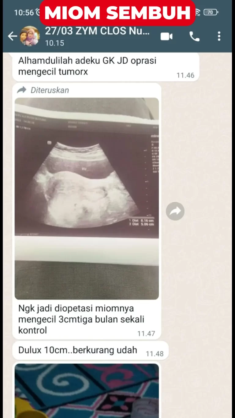 testi-kewanitaan-4-1.webp